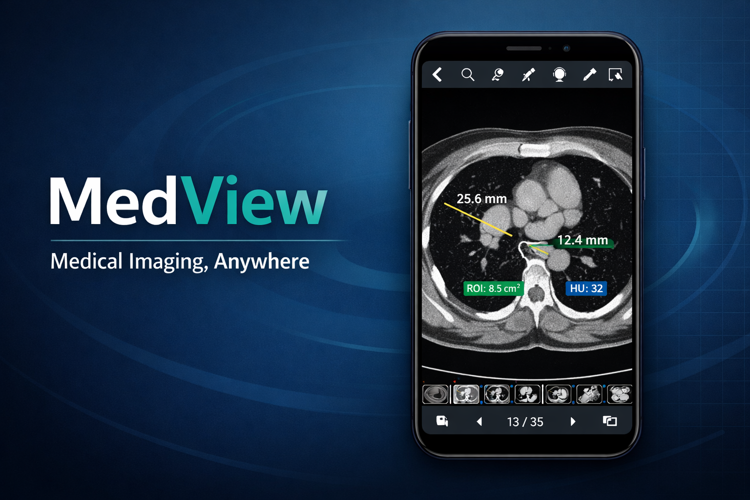 MedView feature overview