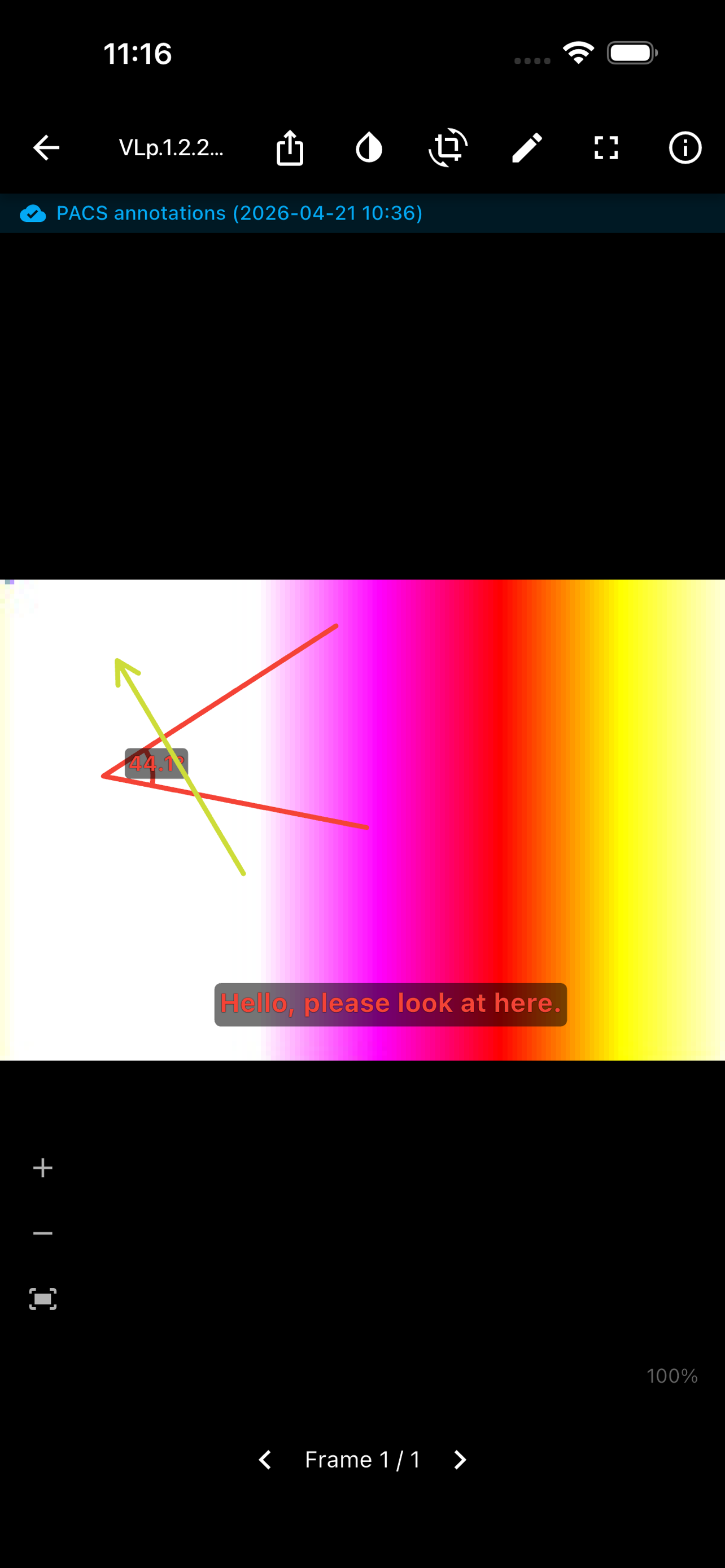 DICOM viewer